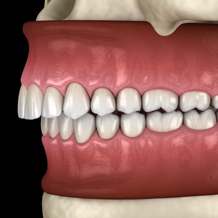 Review dental results