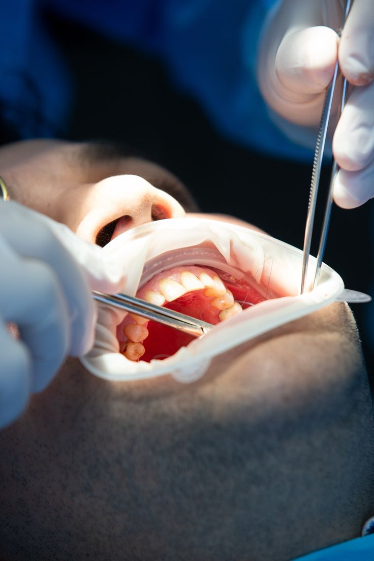 ZendSpeed dentist offering whitening advice