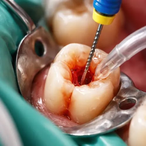 Patient with tooth sensitivity