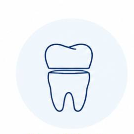 Implant supported bridge model