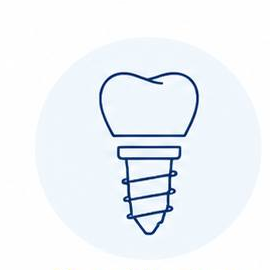 Full mouth implant model
