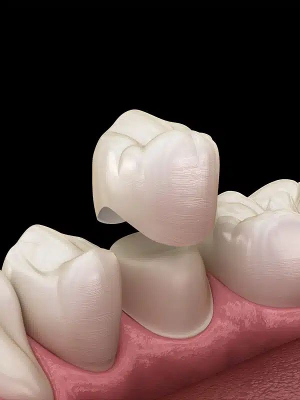 Dentist reviewing a patient's dental x-rays