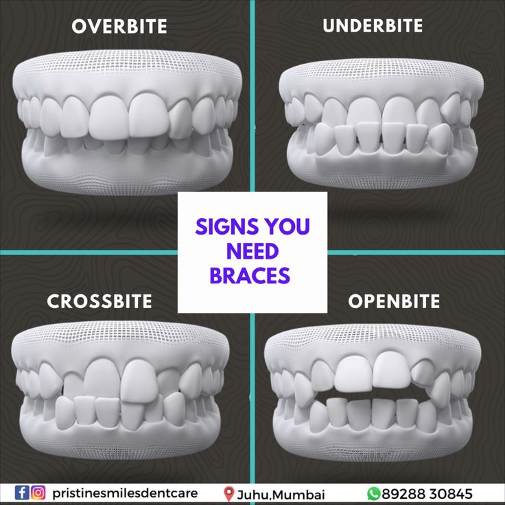 Dental treatment plan