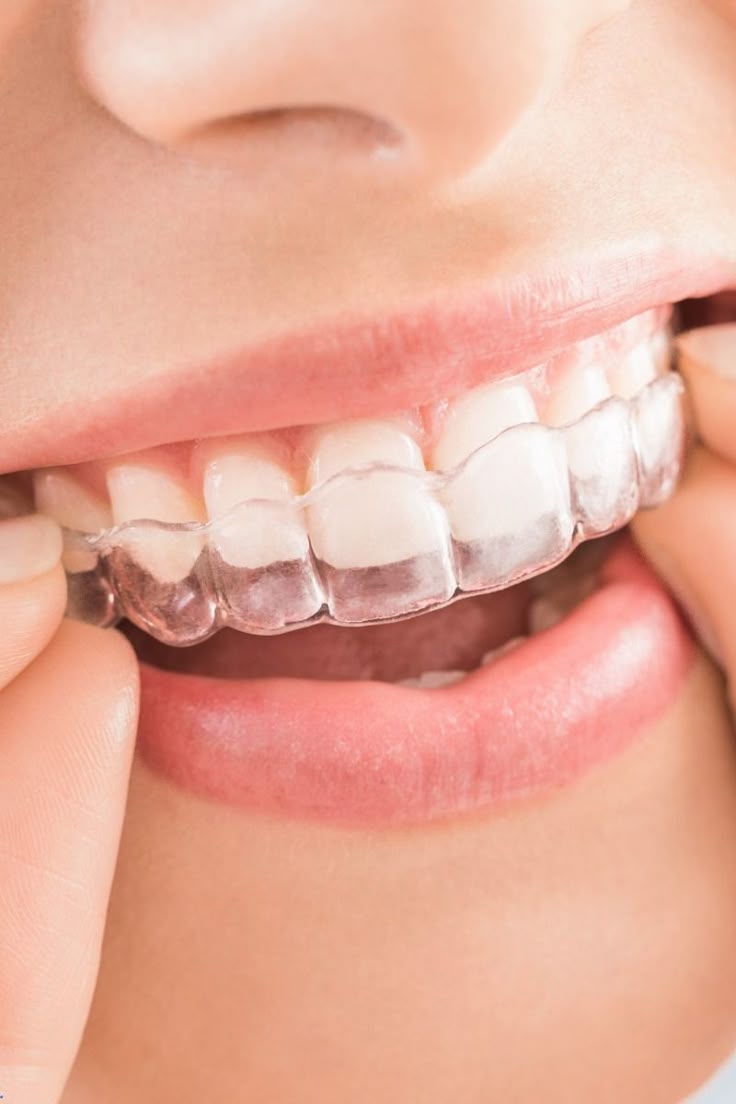 Dental examination focused on gum health